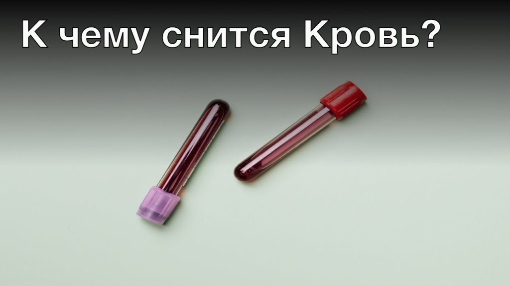 К Чему Снится Кровь: толкования и символизм сновидения